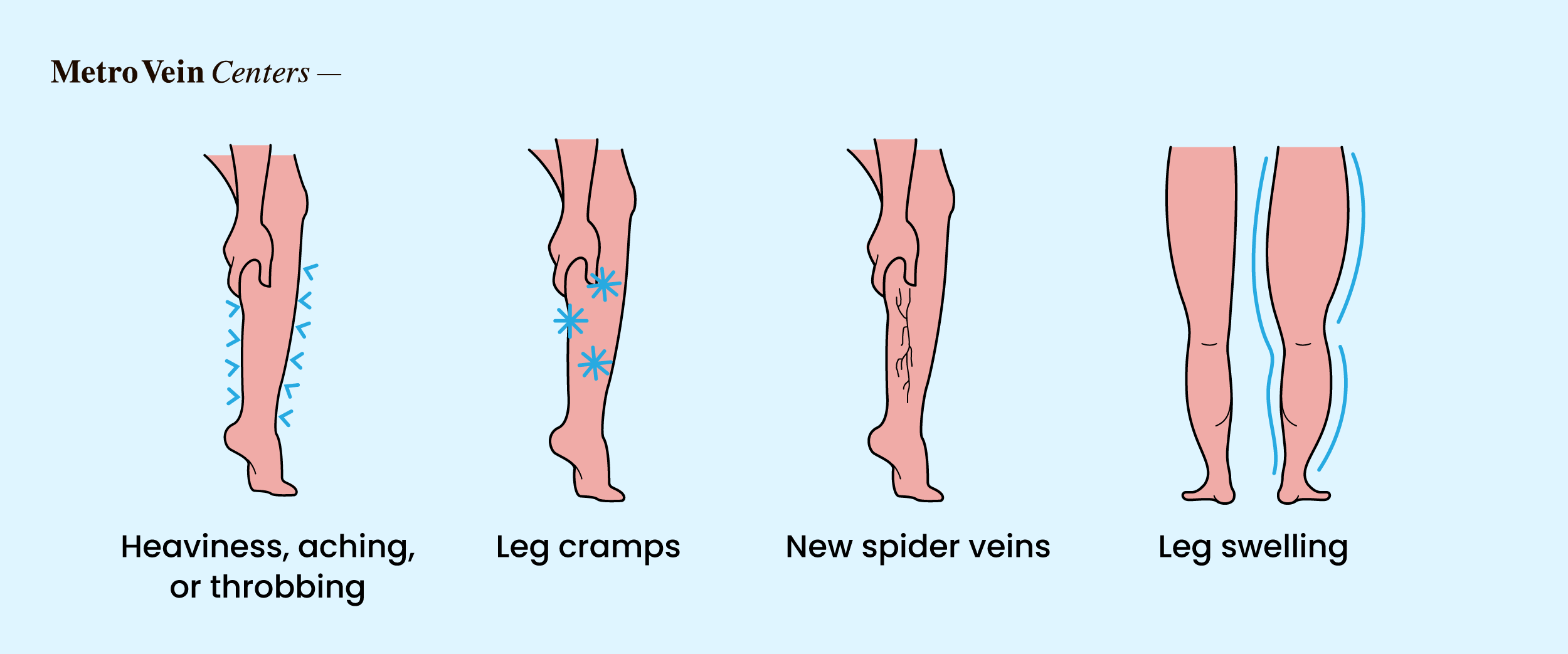 Discover how chronic stress affects leg veins&mdash;from circulation changes to varicose risks&mdash;and proven ways to protect your vein health.