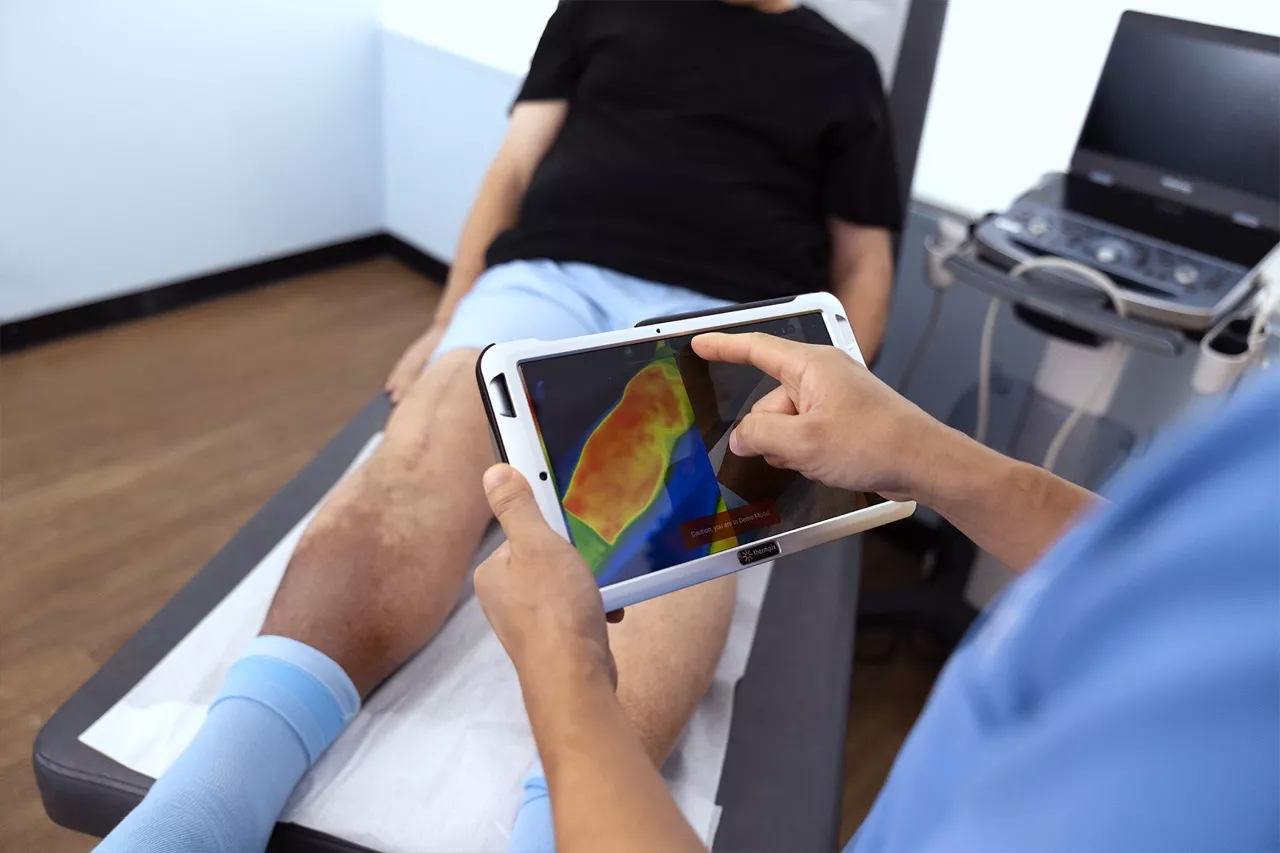 Discover the future of vein treatments and healthcare advancements. Explore cutting-edge technologies like HIFU, robotic-assisted procedures, nanotechnology, and AI-driven personalized care. Learn how genetic insights and improved minimally invasive techniques are revolutionizing vein care for faster recovery, less discomfort, and targeted prevention strategies. Stay informed about innovations shaping a new era in vascular health.