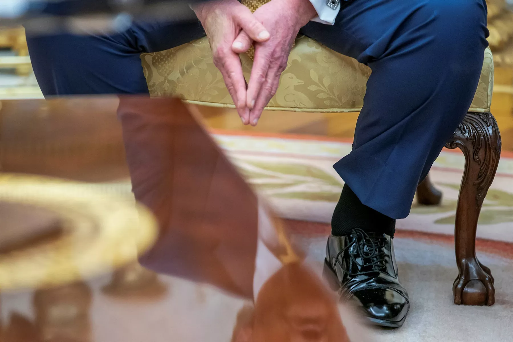 President Trump&rsquo;s chronic venous insufficiency (CVI) diagnosis explained: symptoms, causes, and modern treatments for this common, treatable vein disease.