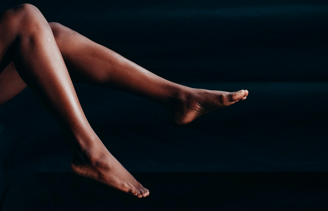 A pair of healthy legs after vein treatments.