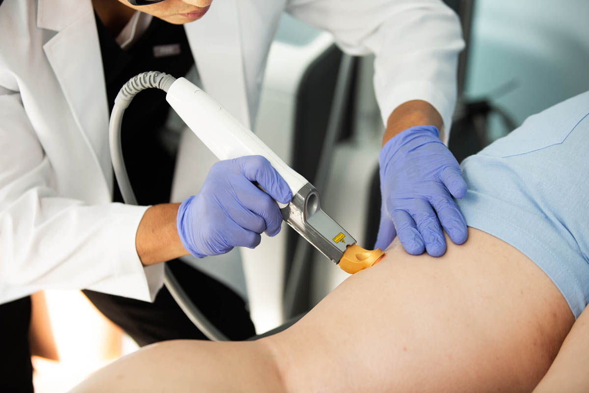 Excel V+ laser treatment at Manhattan Metro Vein Centers