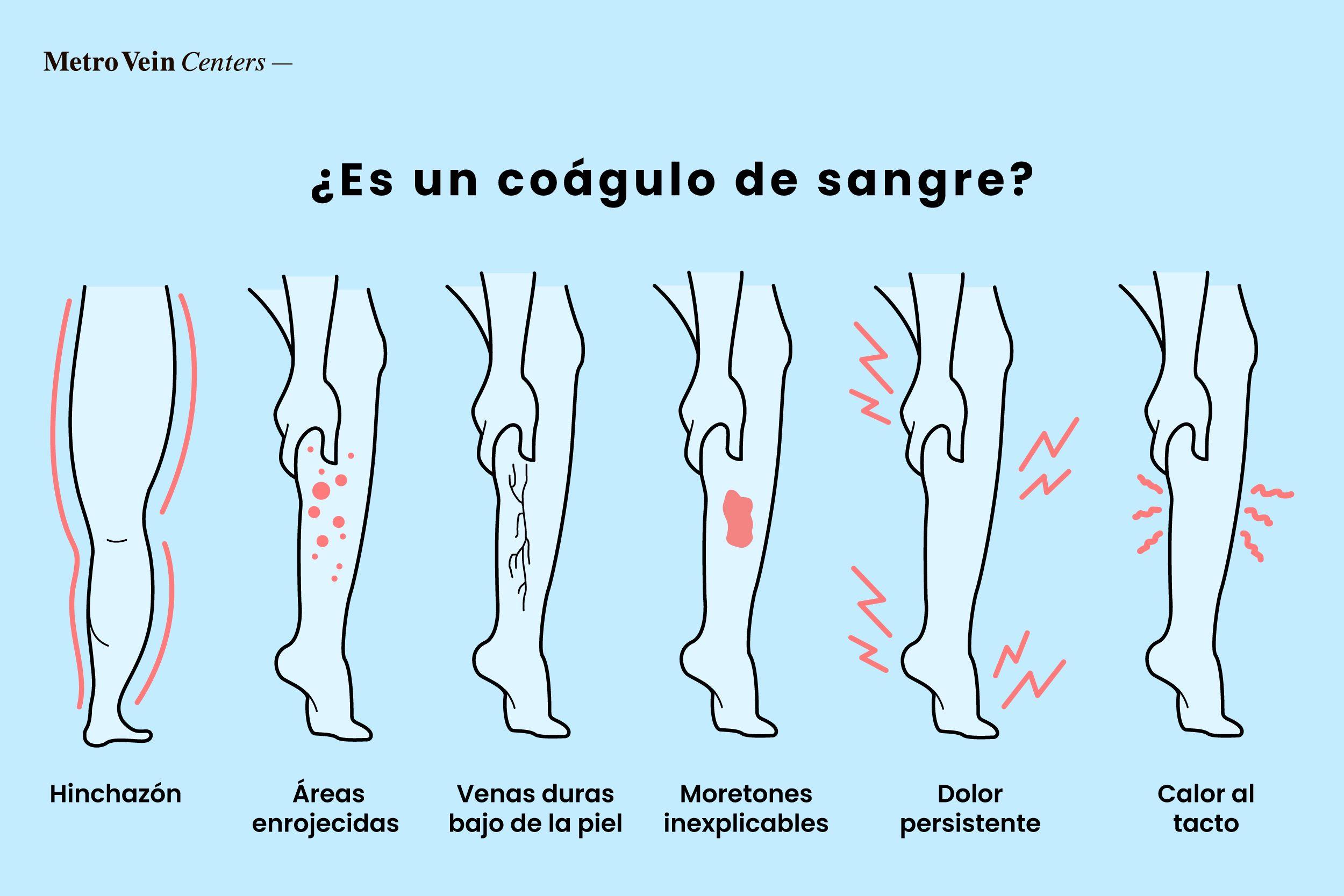 Aprende a identificar co&aacute;gulos de sangre en los tobillos, pies y piernas con im&aacute;genes detalladas. Descubre los s&iacute;ntomas, el diagn&oacute;stico y las opciones de tratamiento para unas piernas m&aacute;s seguras.