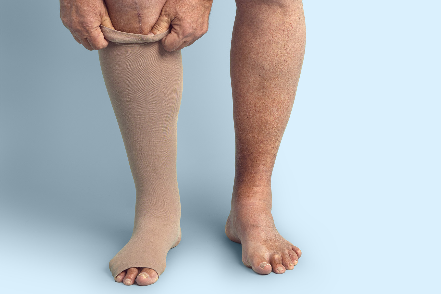 La salud venosa favorece la circulaci&oacute;n, la energ&iacute;a y la movilidad. Prevenga las v&aacute;rices, la insuficiencia venosa cr&oacute;nica (IVC), la hinchaz&oacute;n y la pesadez en las piernas con h&aacute;bitos simples de bienestar.